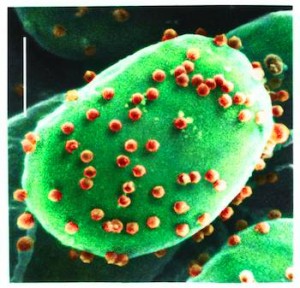 Chlorovirus infectando alga